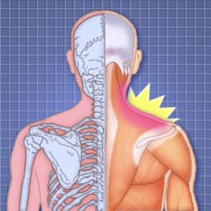 img_shoulder_01_01