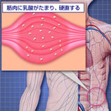 type_img_01.jpg
