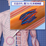 type_img_02.jpg