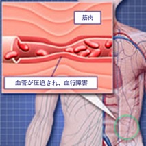 type_img_05.jpg