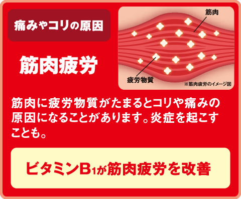肩こり・腰痛の3大原因｜エーザイ株式会社