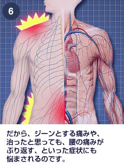 末梢神経のしくみ｜肩・腰のしくみ｜エーザイ株式会社