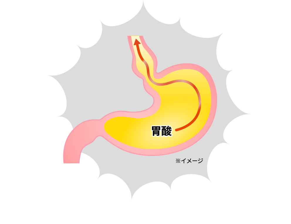 そんな「つらい胸やけ・胃痛」の改善には…