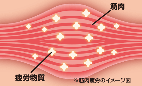 筋肉疲労のイメージ図